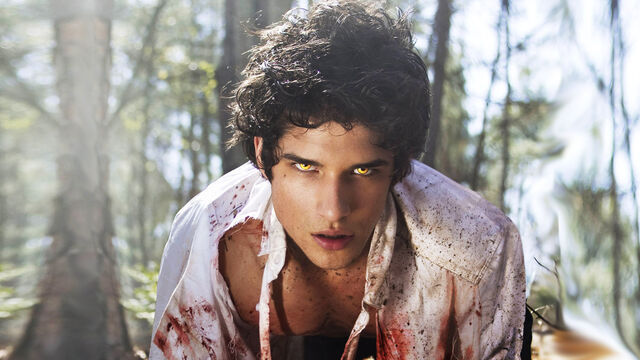 5 Reasons Why This Teen Wolf Scene Was Totally Unnecessary