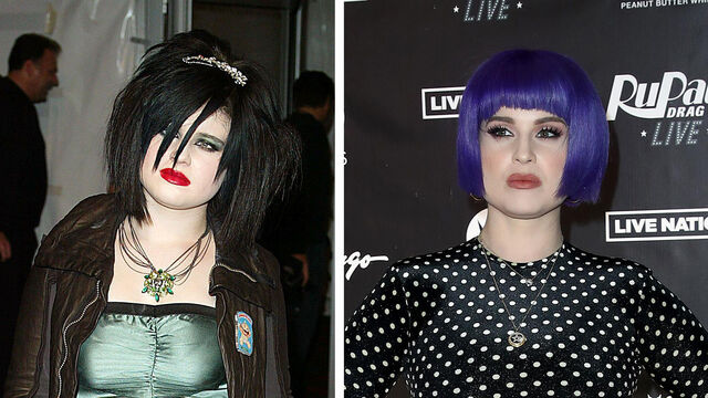 Before and After: the 5 Incredible Celeb Weight Loss Transformations