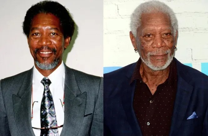 See What These 5 Actors Looked Like Before They Became Famous in Older Age - image 5