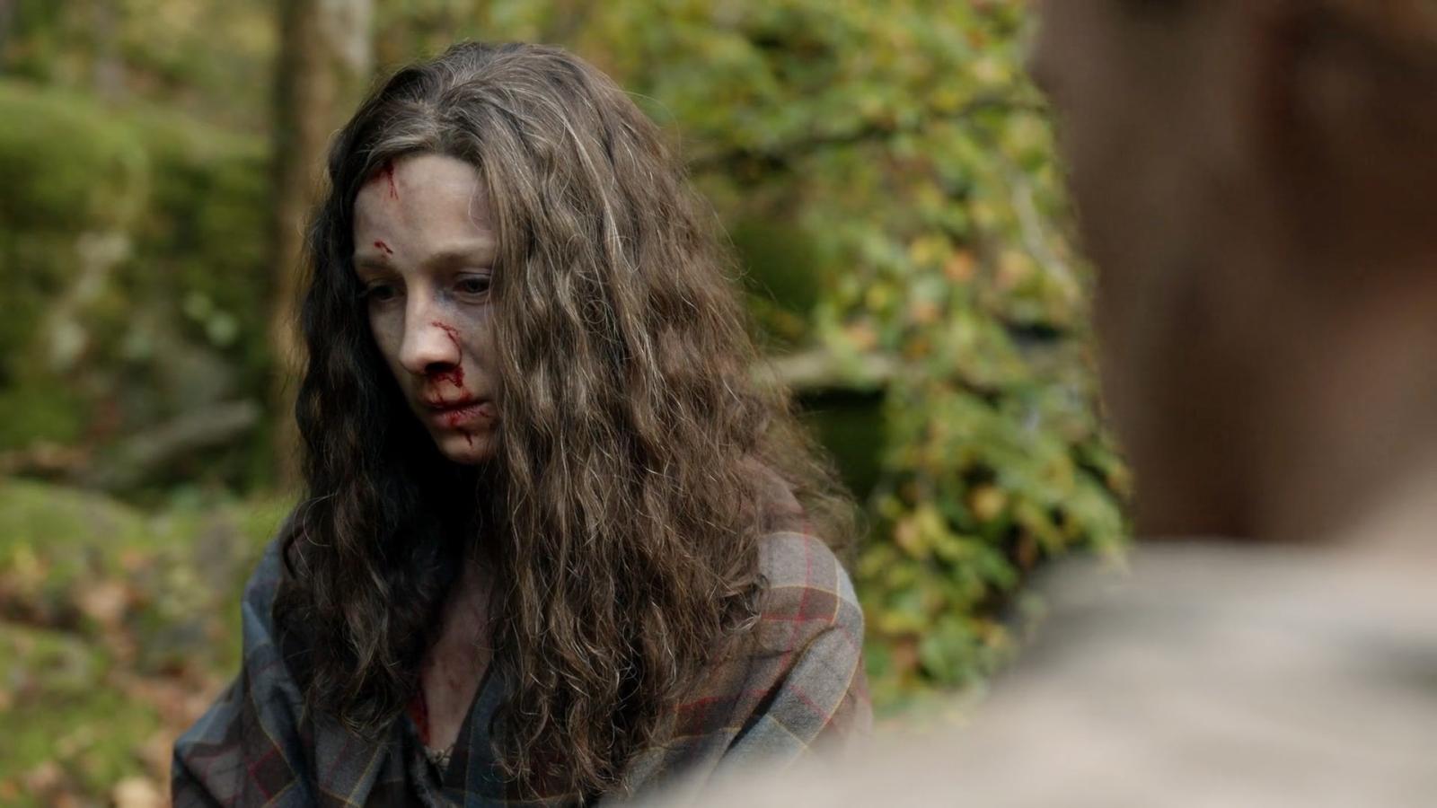 5 Outlander Episodes That Should Come with a Serious Warning - image 5