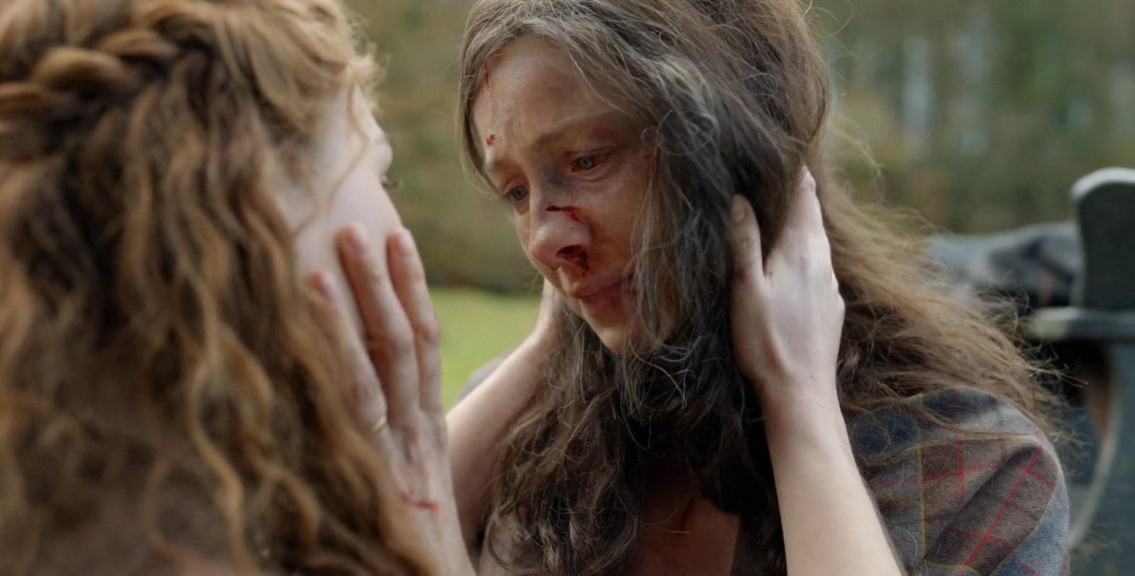 5 Outlander Episodes That Leave Fans Feeling Queasy - image 5