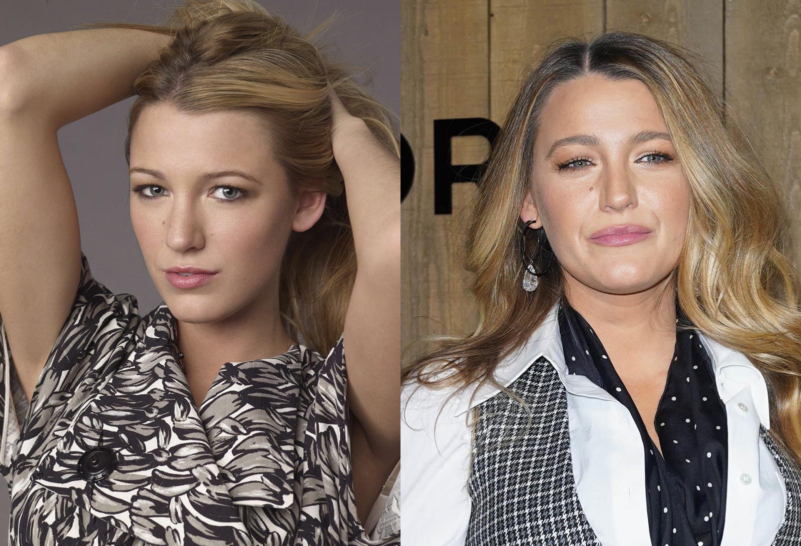 Before and After Pics: Celebrities Who Had Rhinoplasty - image 3