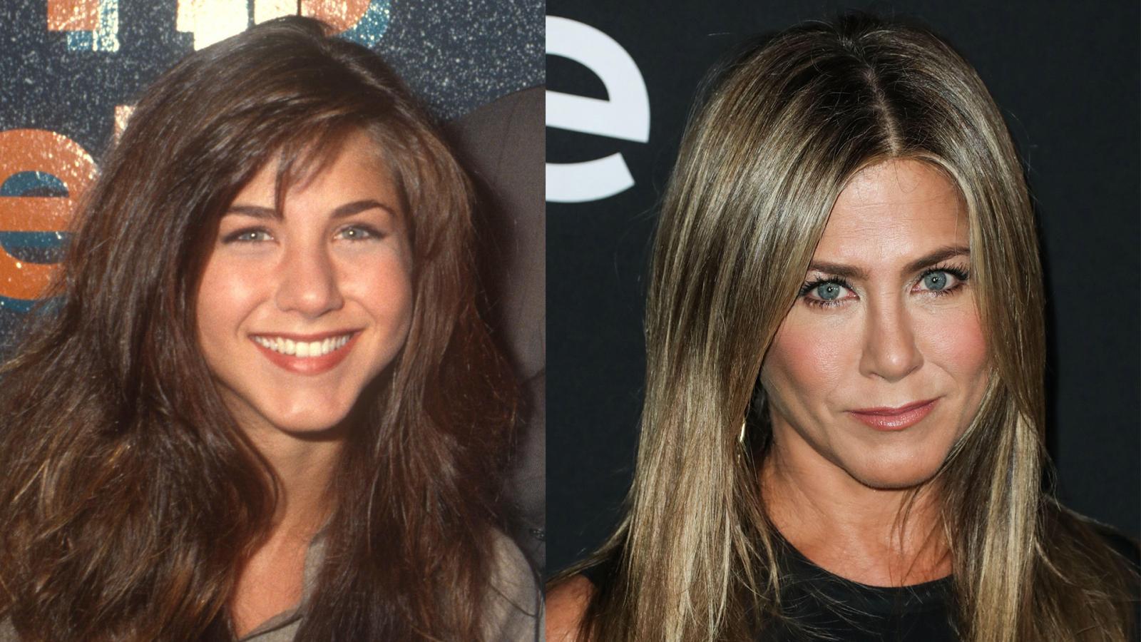 Before and After Pics: Celebrities Who Had Rhinoplasty - image 6