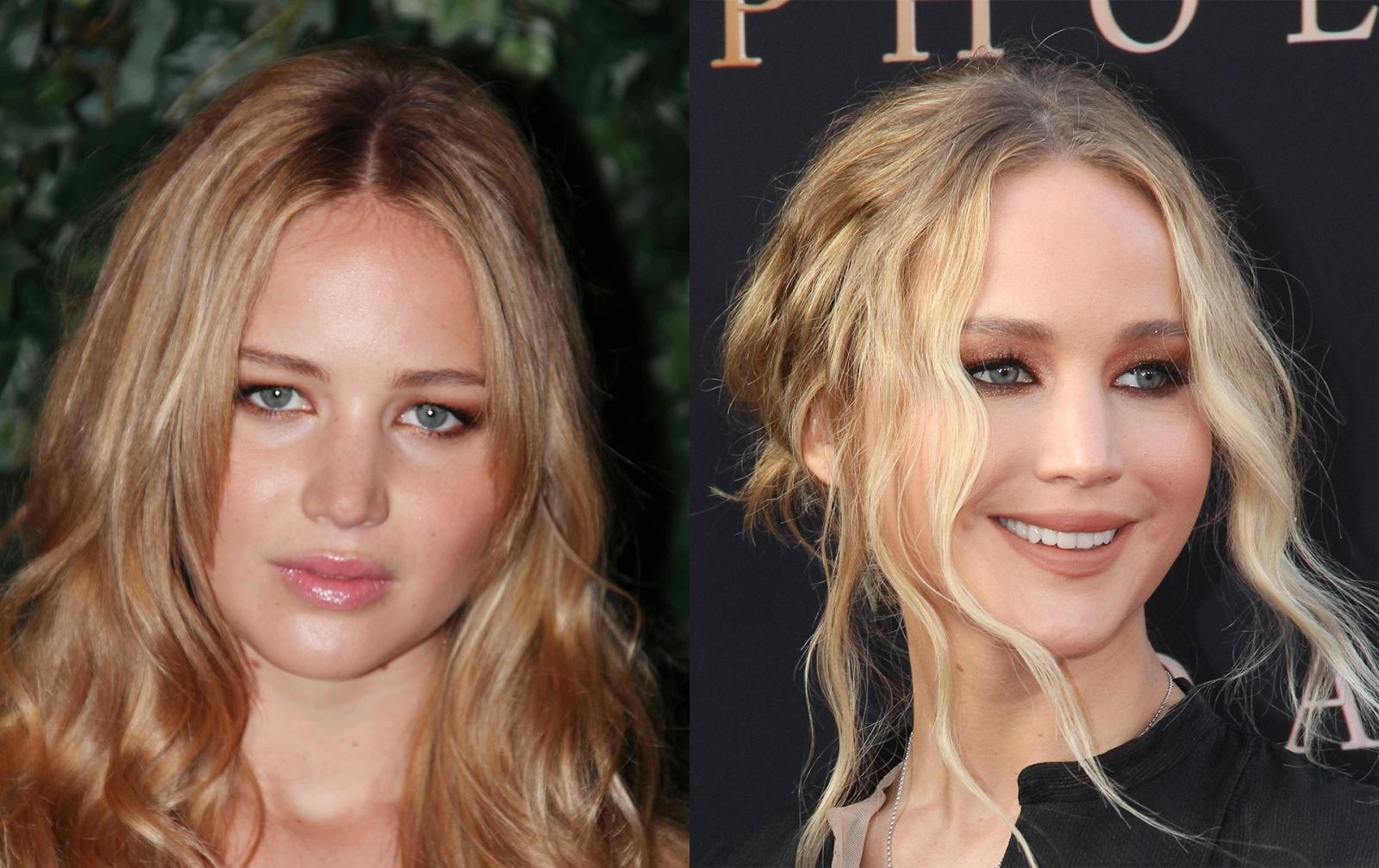 Before and After Pics: Celebrities Who Had Rhinoplasty - image 4