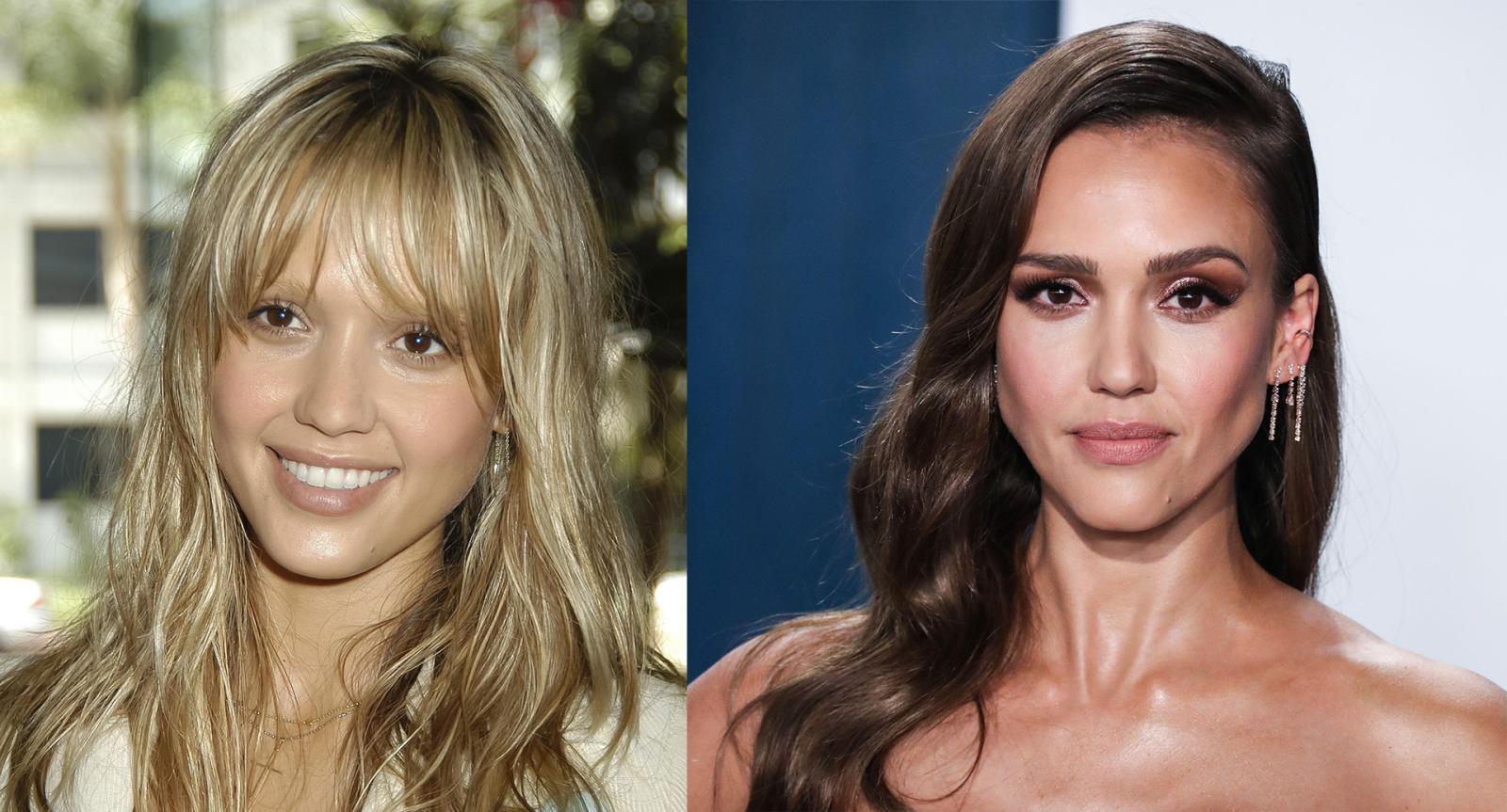 Before and After Pics: Celebrities Who Had Rhinoplasty - image 5