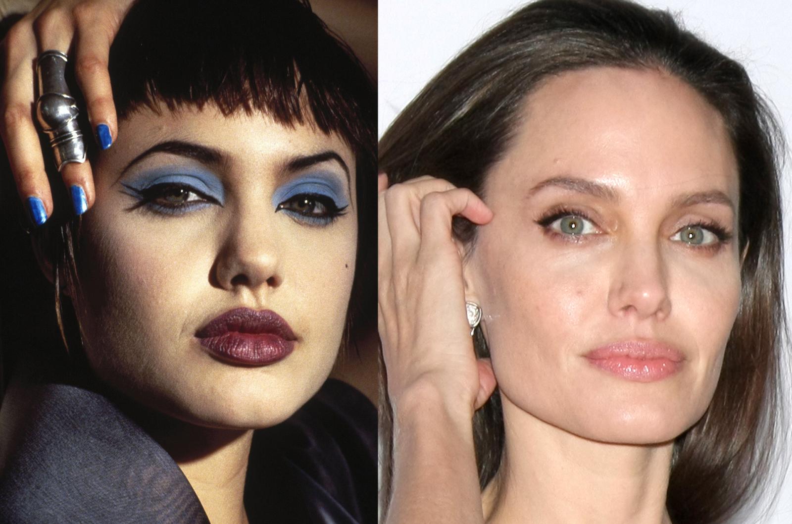 Before And After Pics Celebrities Who Had Rhinoplasty 